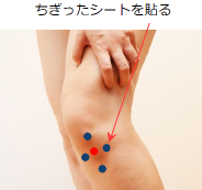 圧痛点の周りに貼る